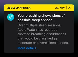 A screenshot from my Apple Health app with a warning from 28. Nov that reads: &quot;Your breathing shows signs of possible sleep apnoea.
Over multiple sleep sessions, Apple Watch has recorded elevated breathing disturbances that would be classified as moderate or severe sleep apnoea.&quot;